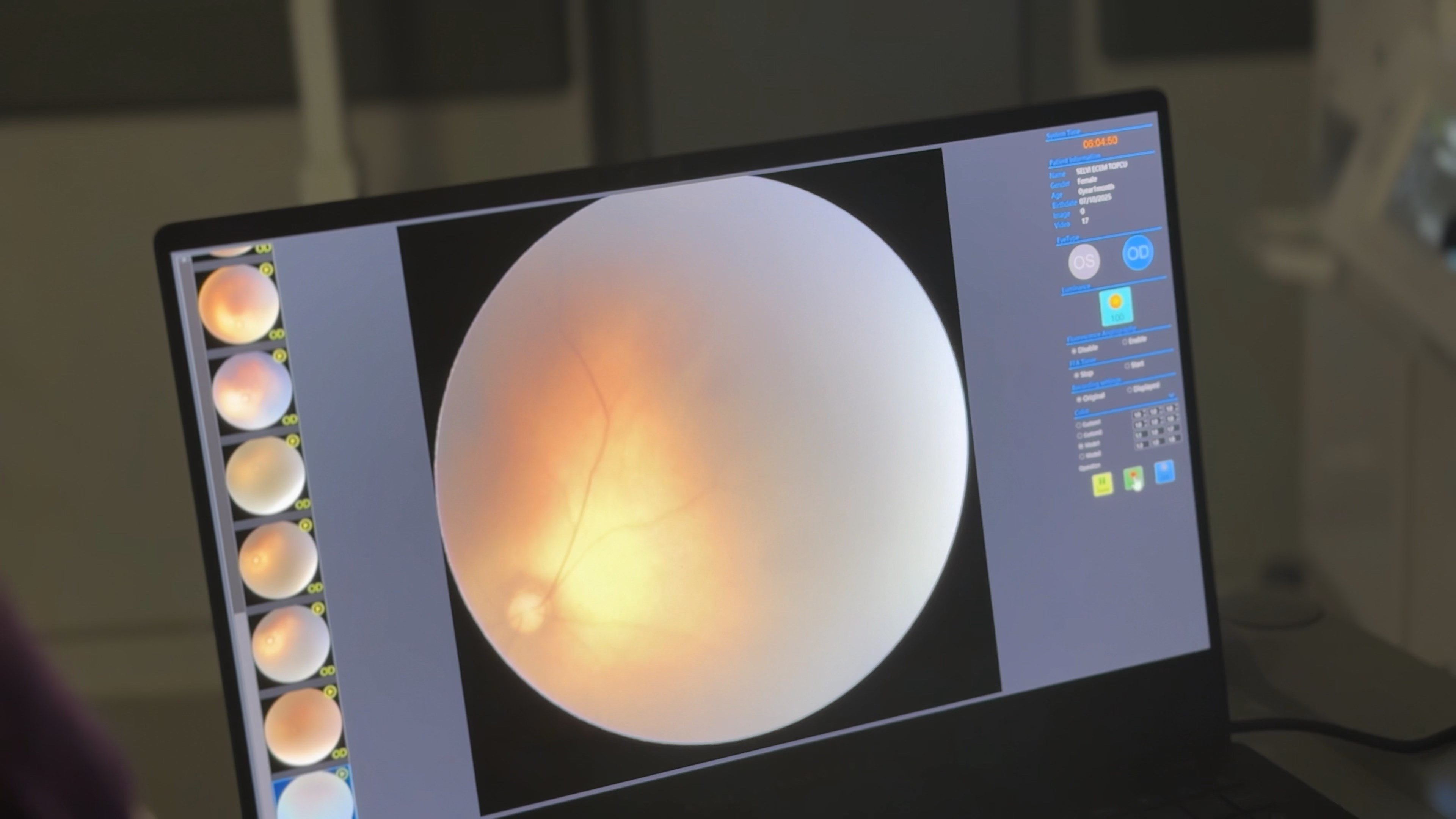 Prematüre bebek tedavisi