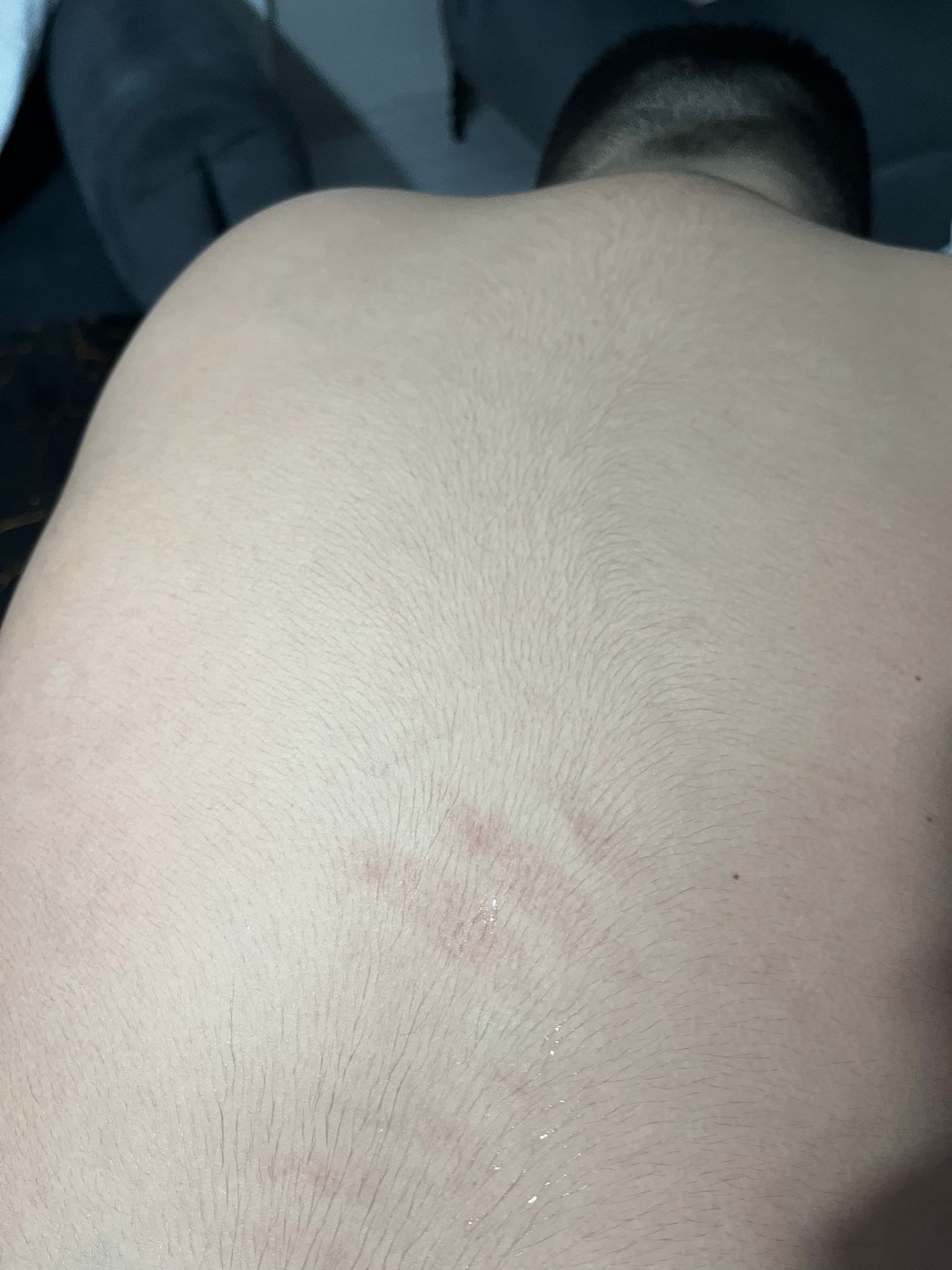 Otizmli çocuk darp raporu şikayet