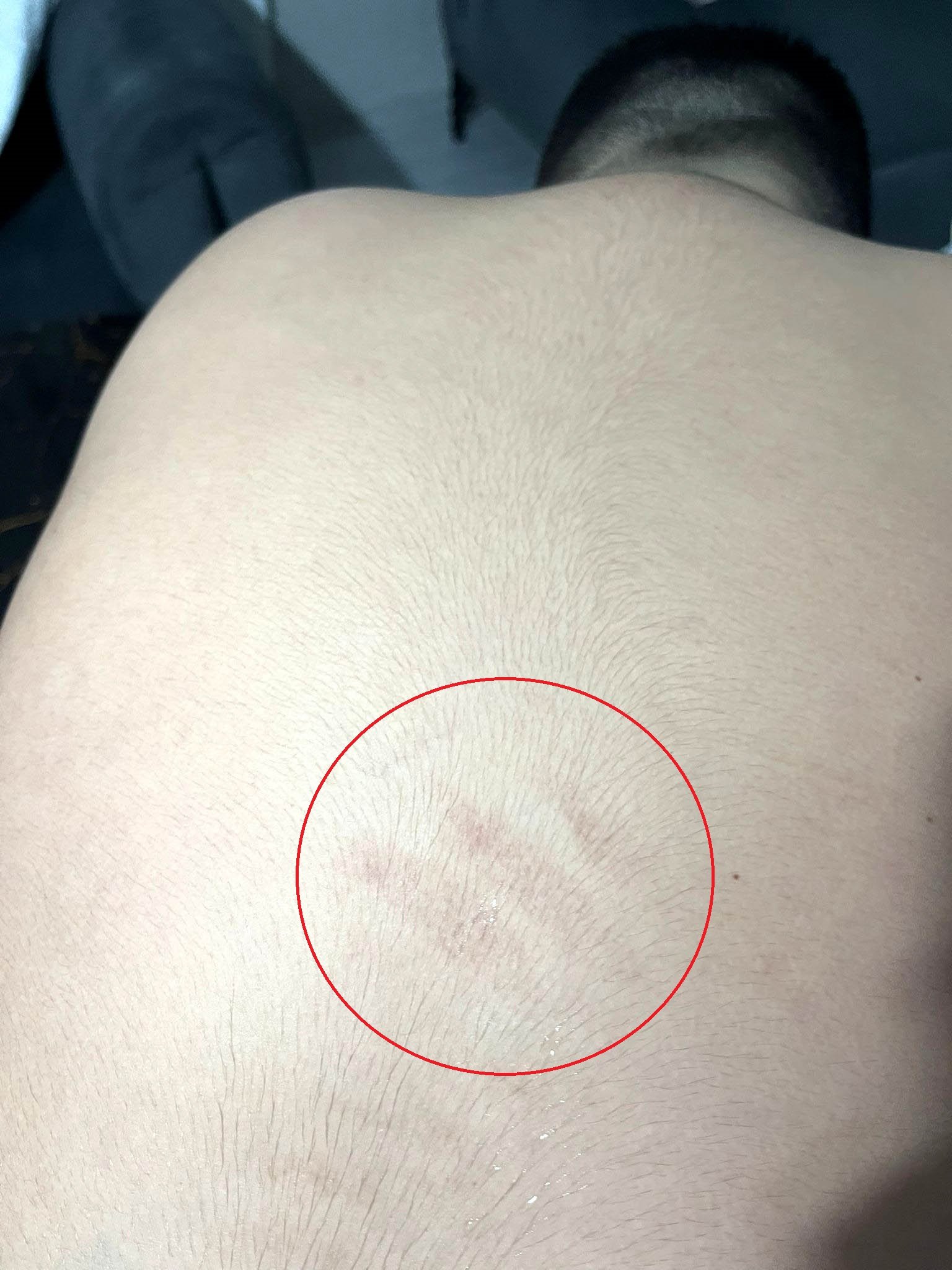 Otizmli öğrenci darp iddiası Ankara Elmadağ