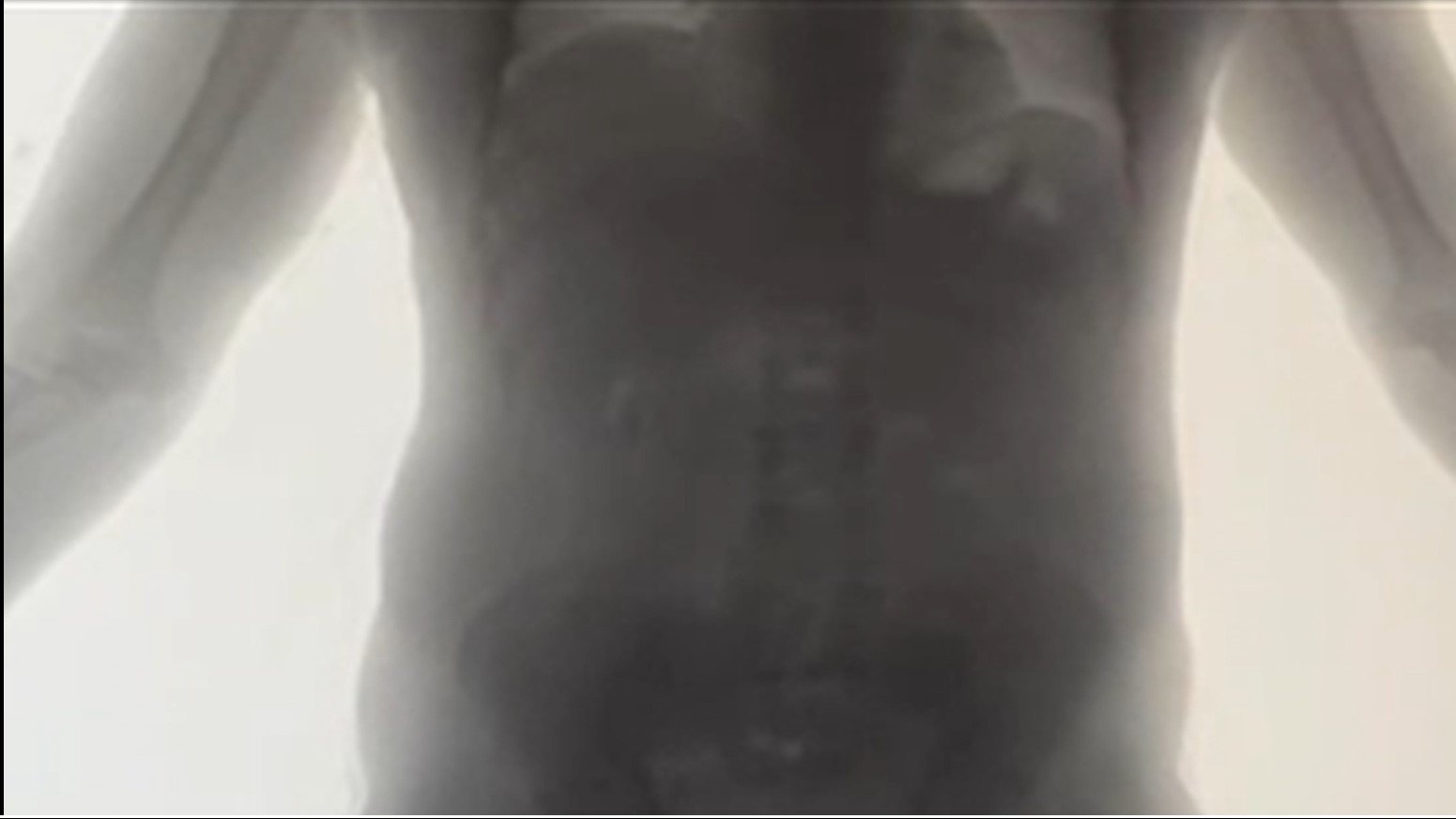 İstanbul Havalimanı Gümrük Muhafaza Operasyonu