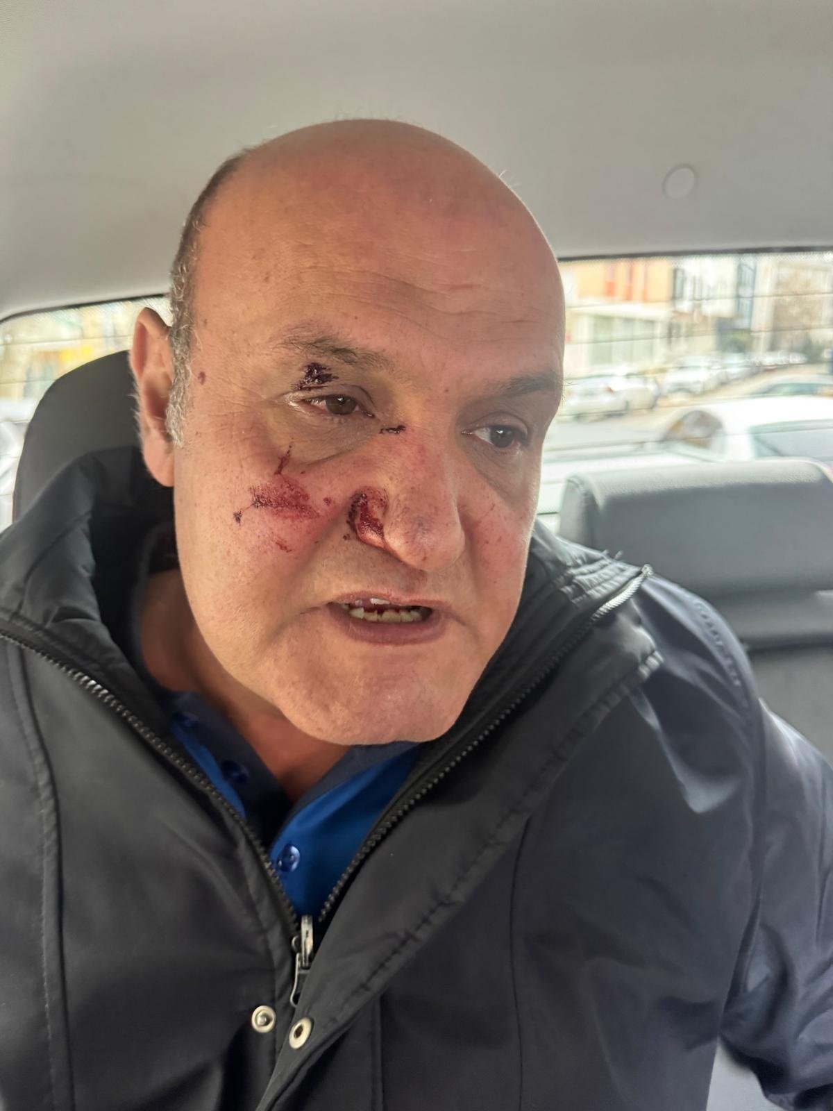 Avcılar Belediye Başkan Yardımcısı hastane ziyareti