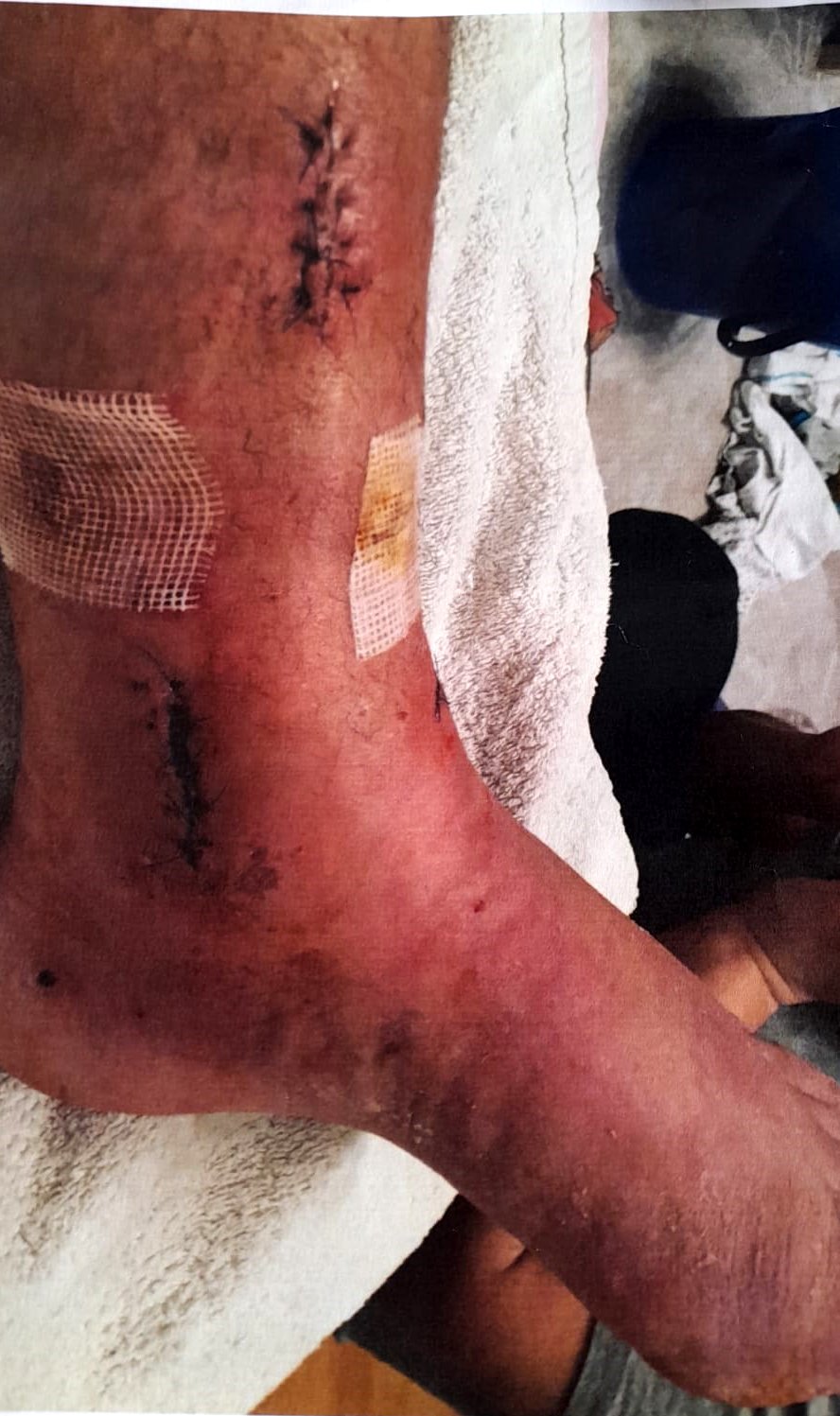 Antalya idare mahkemesi tazminat kararı