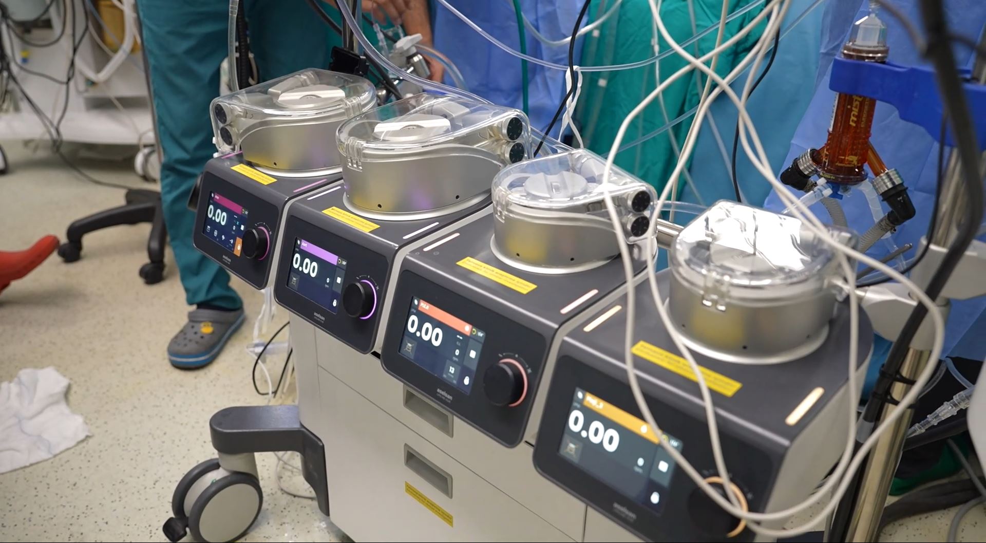 Yerli kalp-akciğer makinesi LIFELINE HLM ile yapılan ilk ameliyatın başarılı olması